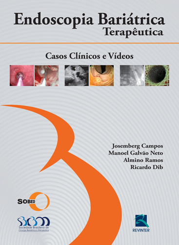 Endoscopia Bariátrica Terapêutica, de Campos, Josemberg Marins. Editora Thieme Revinter Publicações Ltda, capa dura em português, 2013