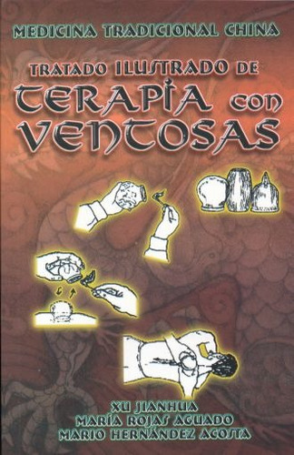 Tratado Ilustrado De Terapia Con Ventosas|, De Xu Jianhua. Editorial Berbera, Tapa Blanda En Español, 2006