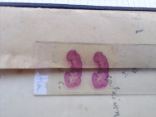 Antigua Colección De Preparados De Microscopio Histología (Usado)