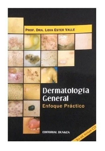 Dermatología General. Enfoque Práctico -plemento, de Lidia Ester Valle. Editorial Dunken en español