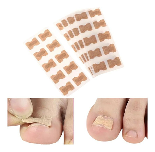 Pegatinas Correctoras Para Uñas Encarnadas 50 Pcs