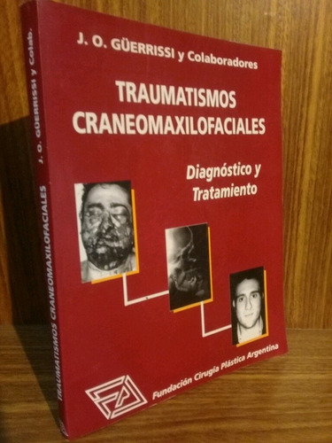 Traumatismos Craneomaxilofaciales, Diag. Y Trat.