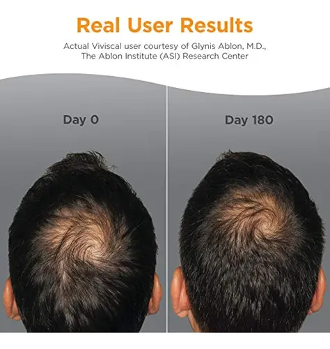 Viviscal Para Hombres - Crecimiento Cabello 180 Tabletas