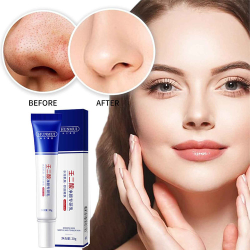 & Un Gel Limpiador Con Ácido Azelaico Reduce Los Poros Y
