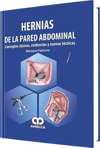 Hernias De La Pared Abdominal Evidencias Y Nuevas Tcn,jk