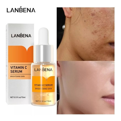 Sérum Lanbena Vitamina C  Blanqueador, Antimanchas 