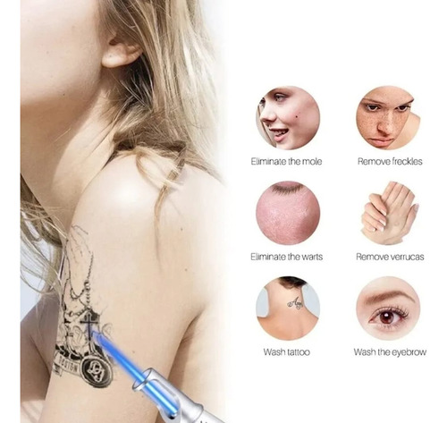 Neatcell Lápiz Láser Rojo Removedor De Manchas, Tatuajes