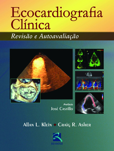 Ecocardiografia Clínica: Revisão e Autoavaliação, de Klein, Allan L.. Editora Thieme Revinter Publicações Ltda, capa dura em português, 2015