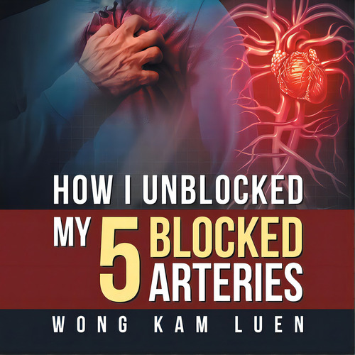 How I Unblocked My 5 Blocked Arteries, De Kam Luen, Wong. Editorial Partridge Pub Singapore, Tapa Blanda En Inglés