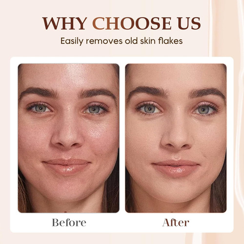 Exfoliante Facial, Exfoliante E Hidratante Para La Piel