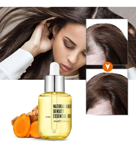 Aceite Esencial Para Dejar Caer El Cabello, 35 Ml, Esencia R