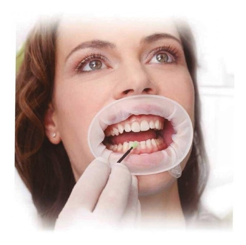 Abreboca Optragate Odontologia