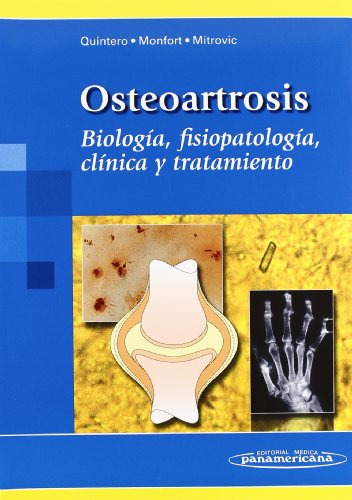 Libro Osteoartrosis De Maritza Quintero, Jordi Monfort Faure