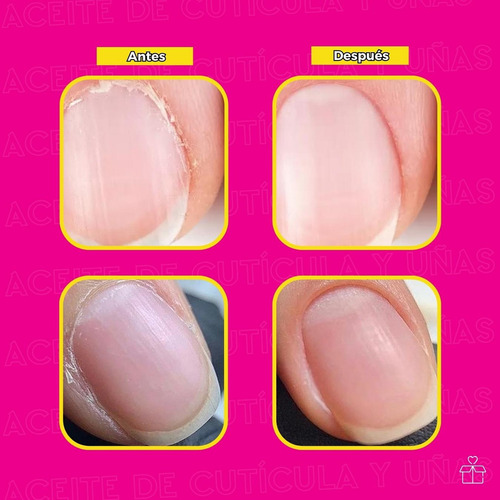 Aceite Para Cutículas Hidratante Para Uñas 24 Piezas Mayoreo Fragancia