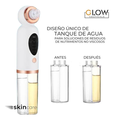 Removedor Y Extractor Hidrafacial De Puntos Negros