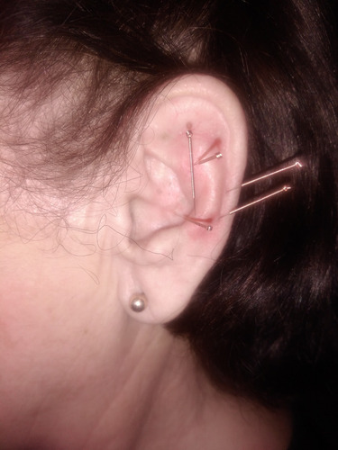 Imagen 3 de 5 de Auriculoterapia Y Podologia Basica