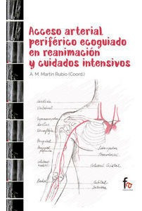 Acceso Arterial Periferico Ecoguiado En Reanimacion Y Cui...
