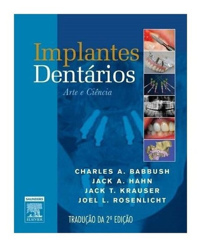 Livro - Implantes Dentários - Babbush