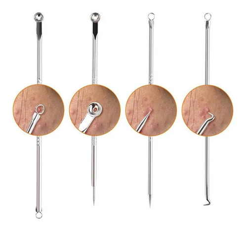 Imagem 3 de 5 de Kit Extrator De Cravo Espinha Profissional Inox 4 Peças