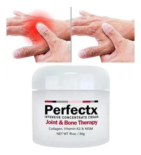 Creme Ósseo Para Articulações De Terapia Intensiva Para