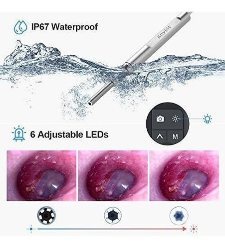 Imagen 5 de 7 de Otoscopio Digital Con Pantalla, Cámara De 3.9 Mm Con 6 Luce