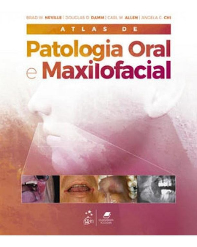 Atlas De Patologia Oral E Maxilofacial, De Neville, Brad W. Et Al.. Editora Gen Guanabara Koogan, Capa Mole Em Português