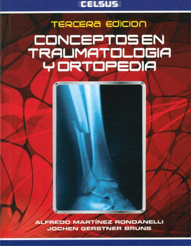 Conceptos En Traumatología Y Ortopedia