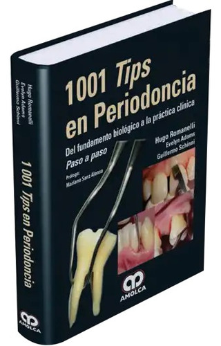 1001 Tips En Periodoncia