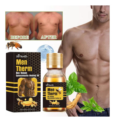 M Aceite Calefactor For Ginecomastia Bee Venoms, 15 Ml*3