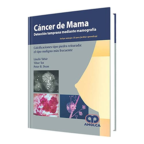 Libro Cancer De Mama Con Anteojos De 3 D De László Tabár, Pe