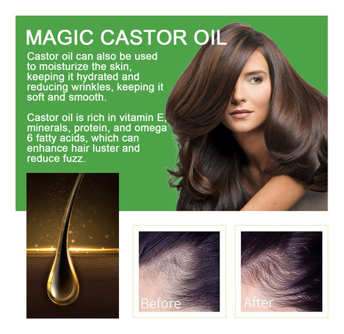 - Aceite De Ricino Castor Oil Natural Puro Y Orgánico,