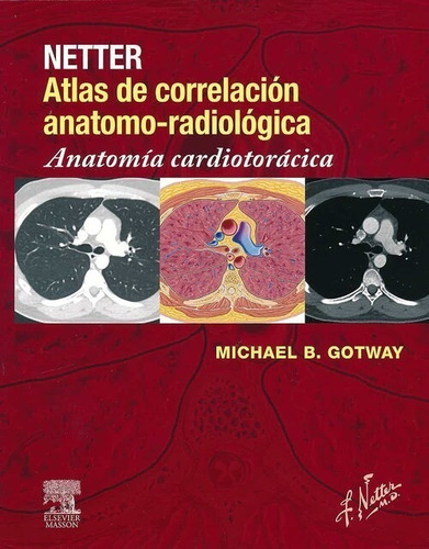Libro Netter: Atlas De Correlación Anatomo-radiológica: An