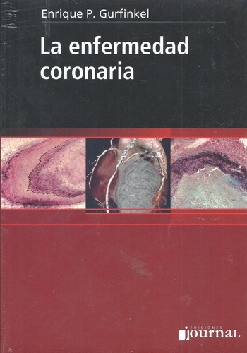 La Enfermedad Coronaria - Gurfinkel - Dyf