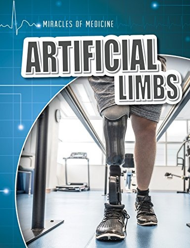Artificial Limbs (miracles Of Medicine)