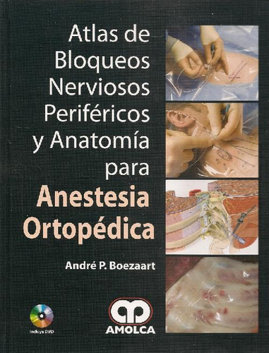 Libro Anestesia Ortopédica Atlas De Bloqueos Nerviosos Perif