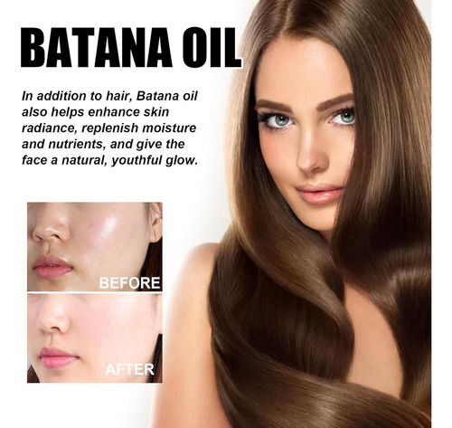 Aceite De Batana Para Crecimiento Del Cabello Hidratada 3pcs