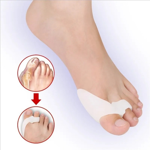 Separador De Dedos Con Protector Para Juanete Color Blanco T