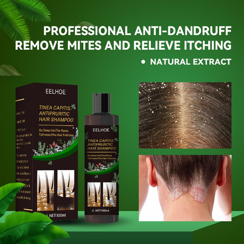 Anti-itch Shampoo For Tinea Capitis To Remove Dandruff And R
