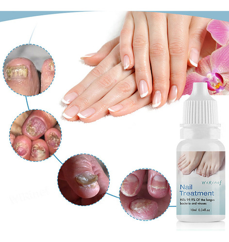 Esmalte Líquido Reparador De Uñas Y Líquido Para Uñas Y Uñas