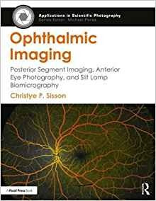 Ophthalmic Imaging Posterior Segment Imaging, Anterior Eye P