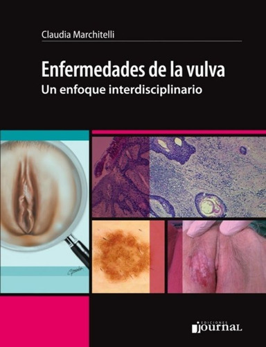 Libro Enfermedades De La Vulva En Enfoque Interdisciplinario