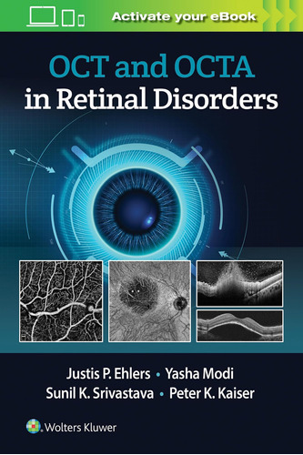 Libro:  Oct And Octa In Retinal Disorders