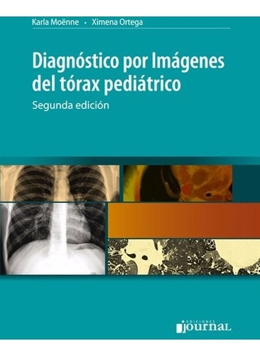 Diagnostico Por Imagenes Del Torax Pediatrico -  Journal
