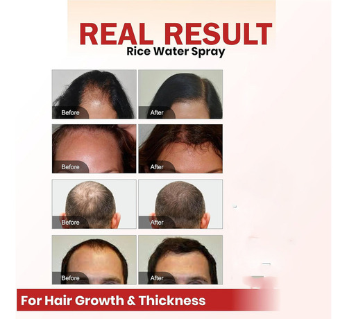 Aceite En Spray For El Crecimiento Del Cabello Batana