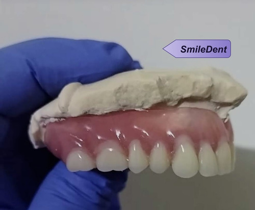 Imagen 4 de 5 de Prótesis Dentales Dentista A Domicilio,o Consul En 4 Días !!