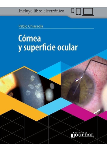 Chiaradia Córnea Superficie Ocular 1ed/2018 Nuevo Env T/país