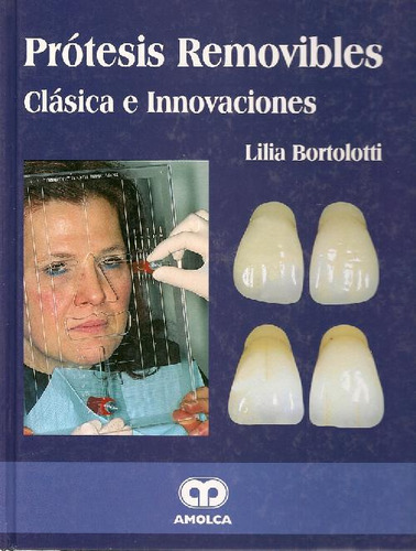 Libro Prótesis Removibles Clásica E Innovaciones De Lilia Bo