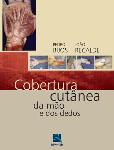 Cobertura Cutânea da Mão e dos dedos, de Bijos, Pedro. Editora Thieme Revinter Publicações Ltda, capa dura em português, 2015