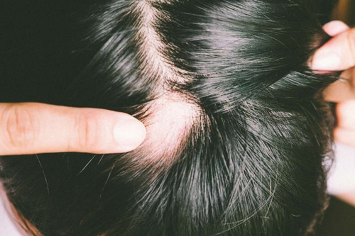 Imagen 4 de 6 de Amplixin Biotina Recuperar Cabello Caído Mejor Color Brillo
