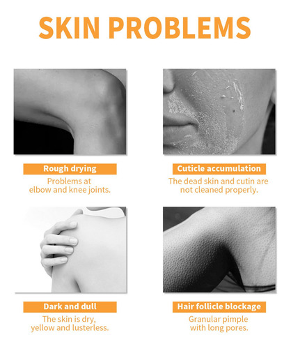 Crema Exfoliante N Papaya Essence Gx7n Hidratante Suavizante